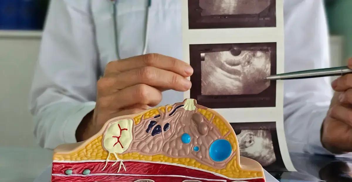 Hapvida inova com programa que acelera diagnóstico de câncer de mama